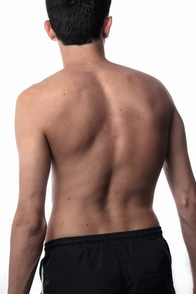 Skoliose, dünner Mann auf dem Rücken, kein Hemd. Krümmung der Drehung — Stockfoto