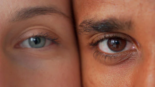 Homme noir et blanc yeux de femmes. concept d'amour de race interraciale. Anti-racisme. — Photo