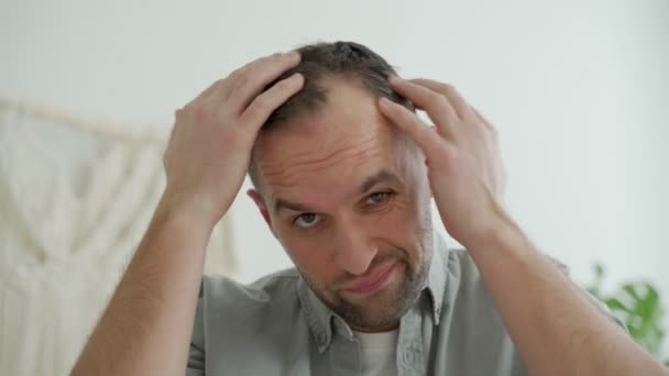 Мужчина смотрит в камеру на свои лысые пятна, проблема выпадения волос — стоковое видео