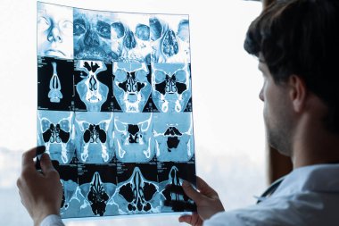 Erkek doktor klinikte bir hastanın röntgenine bakıyor.