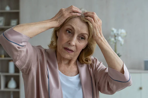 Uma mulher idosa tem problemas com a perda de cabelo. Uma mulher idosa olha para o cabelo no espelho e fica chateada — Fotografia de Stock
