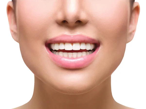 Sonrisa saludable. Blanqueamiento dental . —  Fotos de Stock
