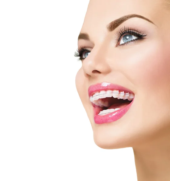 Woman with ceramic braces on teeth — Stock Photo, Image