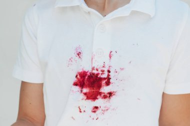 Beyaz çocuk kıyafetlerindeki kirli kırmızı lekeyi kapat. Yüksek kalite fotoğraf