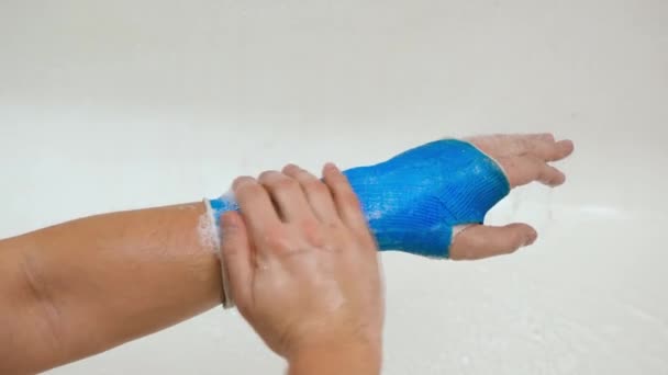 Fiberglas modernt vattentätt bandage — Stockvideo