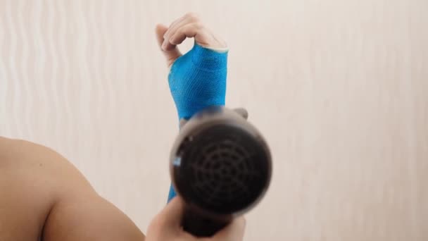 Fiberglass modern waterproof bandage — Stock Video