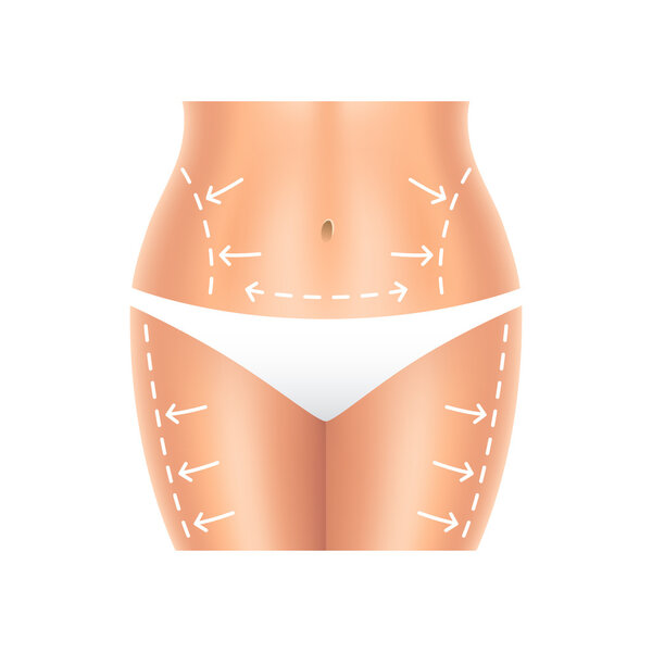 Пластическая хирургия живота и ног изолированный вектор
