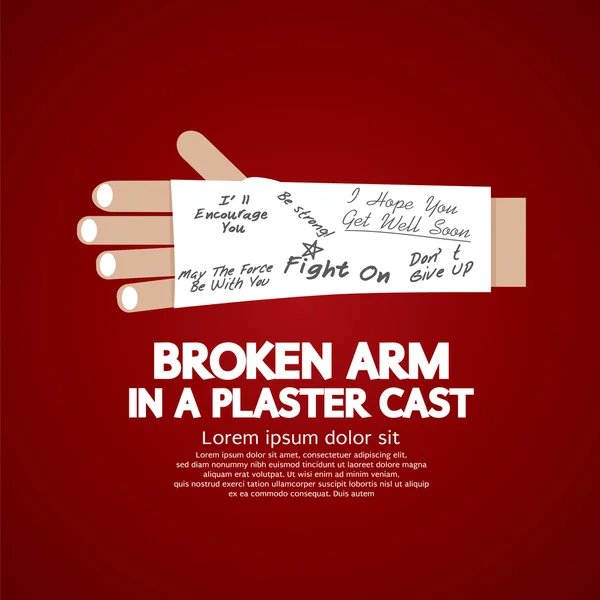 Broken Arm in a Plaster Cast Vector Illustration — Stock Illustration Broken Arm in a Plaster Cast Vector Illustration Stock Illustration