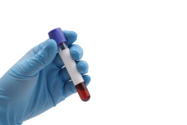 Stüdyo fotoğrafında mavi bir tıbbi eldiven giymiş ve elinde beyazı izole edilmiş kanla dolu bir biyoteknoloji tüpü tutan bir el var. Sığ alan derinliği.