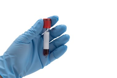 Stüdyo fotoğrafında mavi bir tıbbi eldiven giymiş ve elinde beyazı izole edilmiş kanla dolu bir biyoteknoloji tüpü tutan bir el var. Sığ alan derinliği.