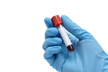 Stüdyo fotoğrafında mavi bir tıbbi eldiven giymiş ve elinde beyazı izole edilmiş kanla dolu bir biyoteknoloji tüpü tutan bir el var. Sığ alan derinliği.