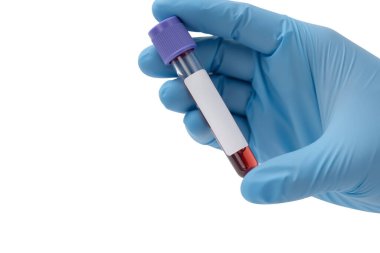 Stüdyo fotoğrafında mavi bir tıbbi eldiven giymiş ve elinde beyazı izole edilmiş kanla dolu bir biyoteknoloji tüpü tutan bir el var. Sığ alan derinliği.