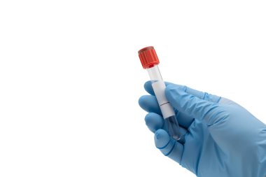 Mavi latekssiz eldiven takmış kırmızı şapkalı bir mikrotüp, profesyonel tıbbi fotoğrafçılık, keskin uçlar..