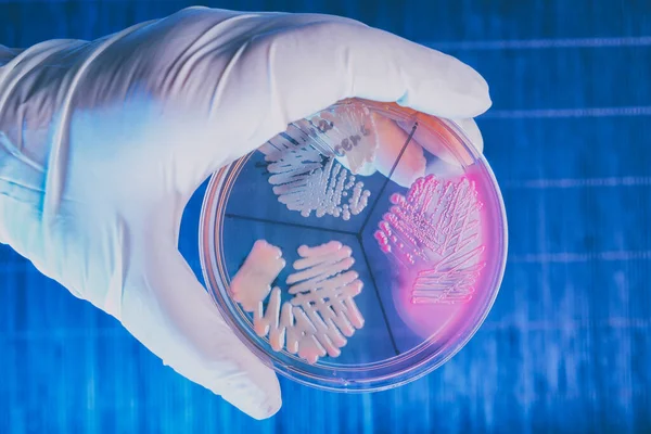 Guanto Mano Con Piastra Petri Contenente Batteri Escherichia Coli Klebisiella — Foto Stock