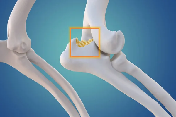 Artrite Canina Osteoartrite Inflamação Articular Deterioração Articulação Cães Articulação Cotovelo — Fotografia de Stock