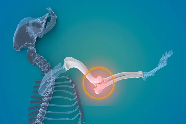 Artrite Canina Osteoartrite Inflamação Articular Deterioração Articulação Cães Articulação Cotovelo — Fotografia de Stock