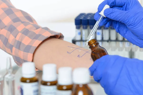 Ιατρός Που Κάνει Δοκιμές Αλλεργίας Στο Εργαστήριο — Φωτογραφία Αρχείου