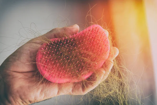 Problema Perda Cabelo Mão Masculina Segurando Escova Cabelo Com Cabelo — Fotografia de Stock