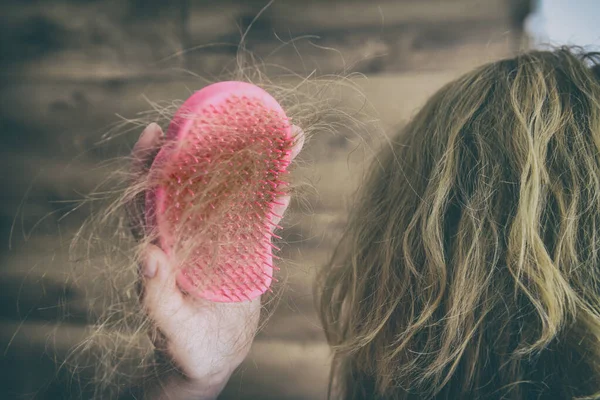 Haaruitval Probleem Vrouwelijke Hand Houden Haarborstel Met Haar Rechtenvrije Stockafbeeldingen