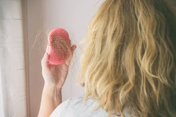 Hair Loss Problem Female Hand Holding Hairbrush Hair — Stock Photo, Image