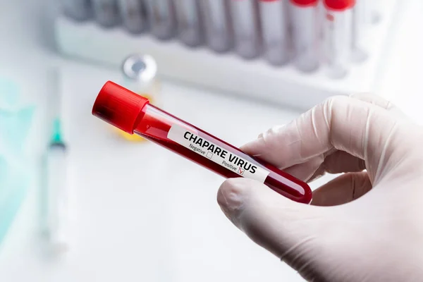 Nurse Wearing Respiratory Mask Holding Positive Blood Test Result Chapare — Stock Photo, Image