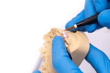 Diş teknisyeni, laboratuarında seramik diş implantı kullanan bir fırça kullanıyor..