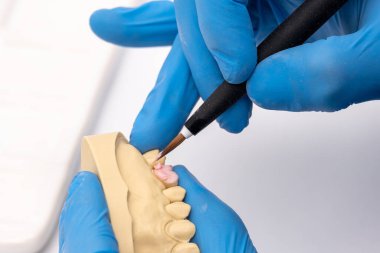 Diş teknisyeni, laboratuarında seramik diş implantı kullanan bir fırça kullanıyor..