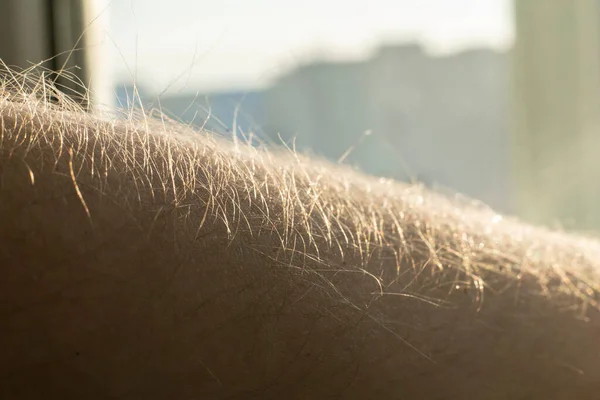 Ett upphöjt hår på armen som tecken på känslor, upphetsad och nervös — Stockfoto