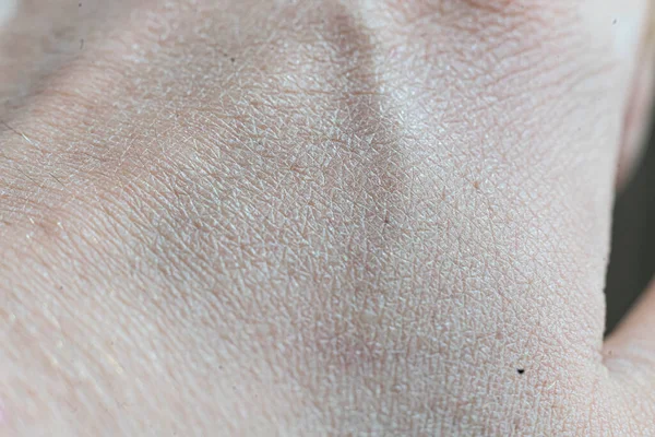 Zbliżenie makro tekstury ludzkiej skóry kaukaskiej — Zdjęcie stockowe