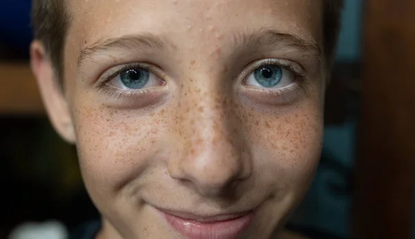 Pequeno Menino Olhos Azuis Sorrindo Fora — Fotografia de Stock