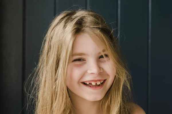 Closeup Smiling Young Girl Missing Teeth — Stock Photo, Image