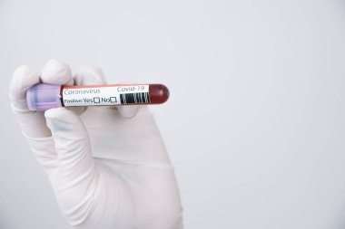 Beyaz arka planda içi kan dolu bir tüp tutan lateks eldiven giymiş bir el. Coronavirus konsepti.