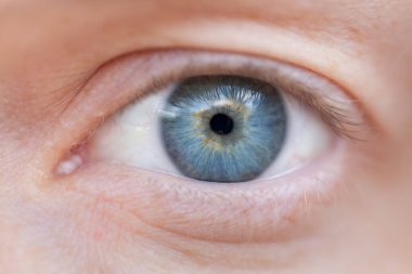 Merkezden kaynaklanan benzersiz bir renge sahip bir gözün yakın çekimi.