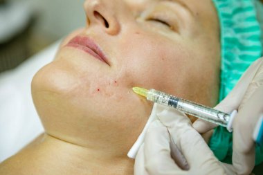 Bir kadının yüzüne botoks yapmak.