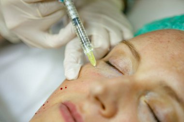 Bir kadının yüzüne botoks yapmak.