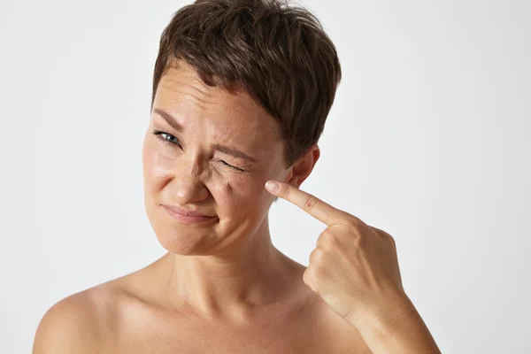 Mujer mostrando arrugas alrededor del ojo — Foto de Stock