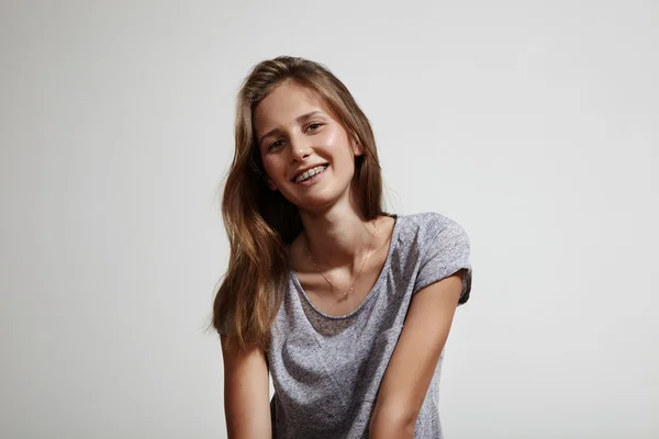 Menina com suportes dentários — Fotografia de Stock