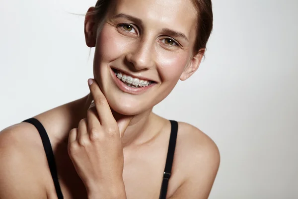 Chica con soportes dentales — Foto de Stock