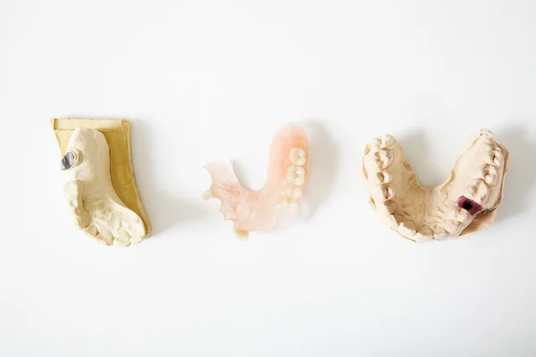 Diş alçı kalıpları — Stok fotoğraf