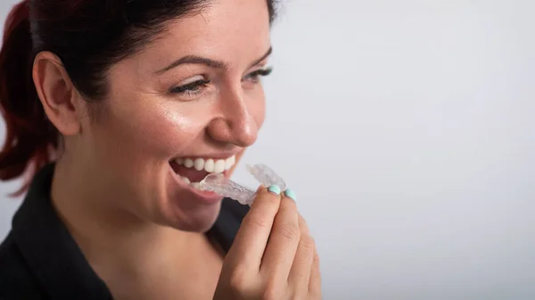 Mujer de negocios se pone retenedores transparentes para enderezar los dientes — Foto de Stock