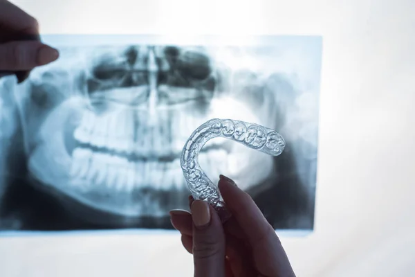 Manos femeninas con protectores bucales transparentes para corregir la mordida y la radiografía de la mandíbula. El ortodoncista sostiene el equipo del ortodoncista — Foto de Stock
