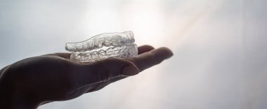 Kadın ellerindeki dişleri düzeltmek için şeffaf tepsiler. Çıkarılabilir plastik koruyucular