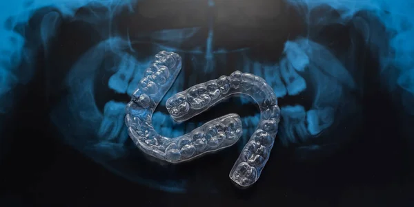 Bandejas transparentes de corrección de mordeduras y rayos X de la mandíbula. Equipos ortodoncistas — Foto de Stock