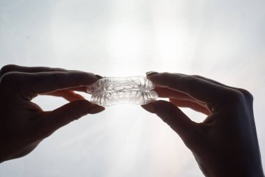 Kadın ellerindeki dişleri düzeltmek için şeffaf tepsiler. Çıkarılabilir plastik koruyucular