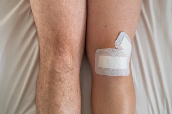 Крупный план мужских ног с примотанным скотчем коленом после лапароскопической операции миниска — стоковое фото