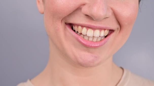 Close-up portret van een vrouw met een plastic transparante beugel. Een meisje corrigeert een beet met behulp van een orthodontisch apparaat — Stockvideo