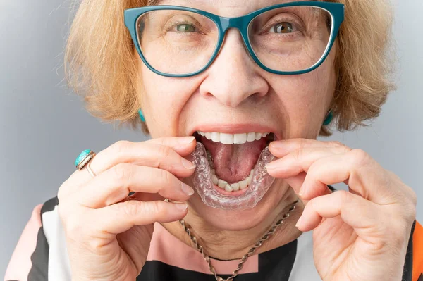 A happy elderly woman puts on transparent removable braces. Cosmetic dentistry for all ages — Stock Photo, Image