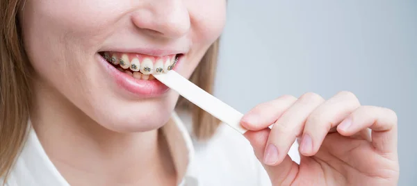 Young woman with metal braces on her teeth is chewing gum. The girl is eating gummy candy — Stock Photo, Image