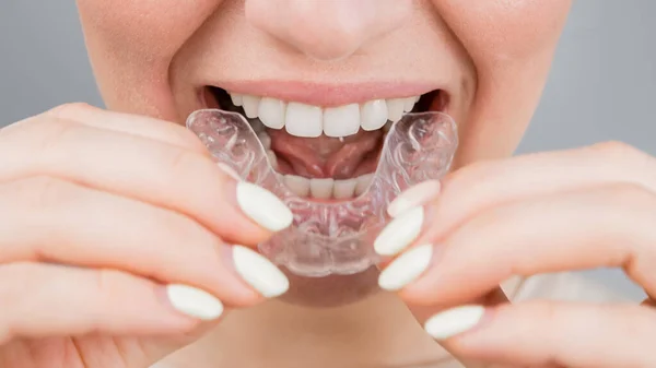 Şeffaf plastik diş teli takan bir kadının yakın plan portresi. Bir kız ortodontik aletin yardımıyla ısırığı düzeltir.