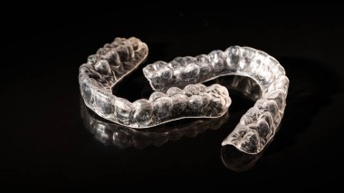 Siyah arkaplandaki ısırık düzeltmeleri için çıkarılabilir plastik diş telleri